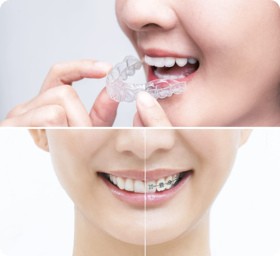 豊富な選択肢からあなたに合った矯正を