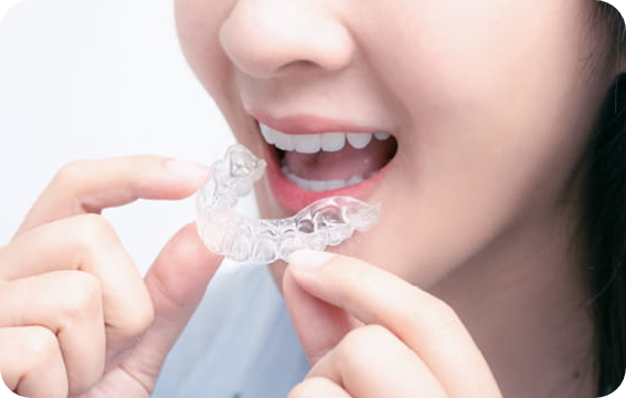 マウスピース矯正